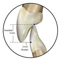 Ортодонтия Семинар/ Orthodontic Seminar