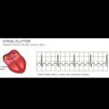 medicines and ECG