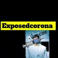 Exposedcorona