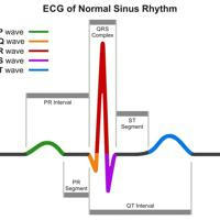 ECG with RB 🫀