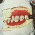 Prosthodontics - 3rd 🦷