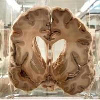 مغز و اعصاب