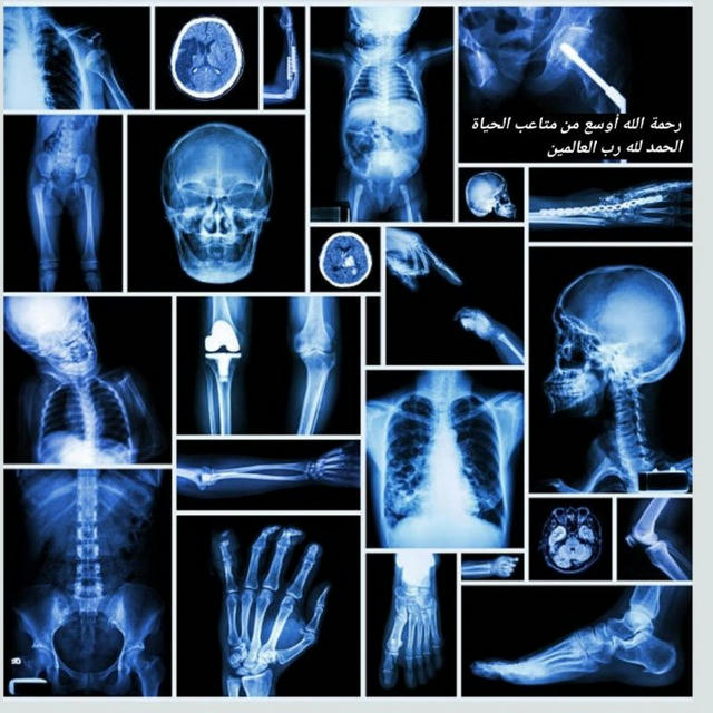 اشعاعيون😊❤️