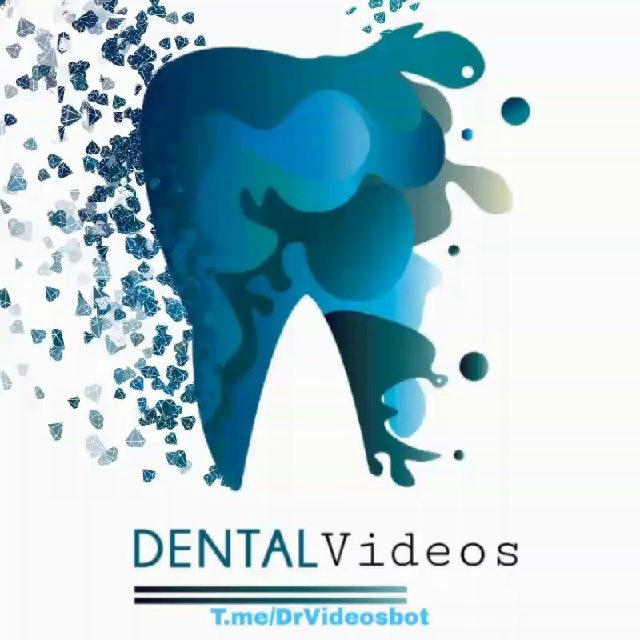 Dental Videos