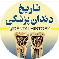 کانال تاریخ دندانپزشکی