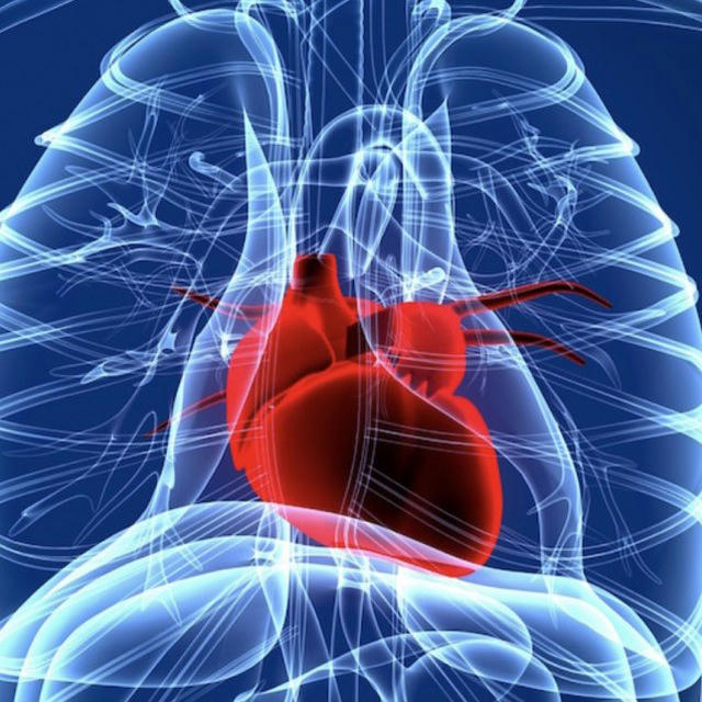 (Cardiothoracic) Anaesthesia and ICU (cardiac)