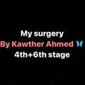My surgery