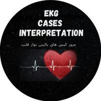 EKG cases interpretation