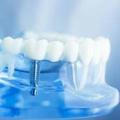Нестрашная стоматология
