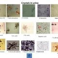 Msq Urinalysis