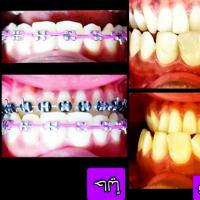 Dentistryand orthodontic