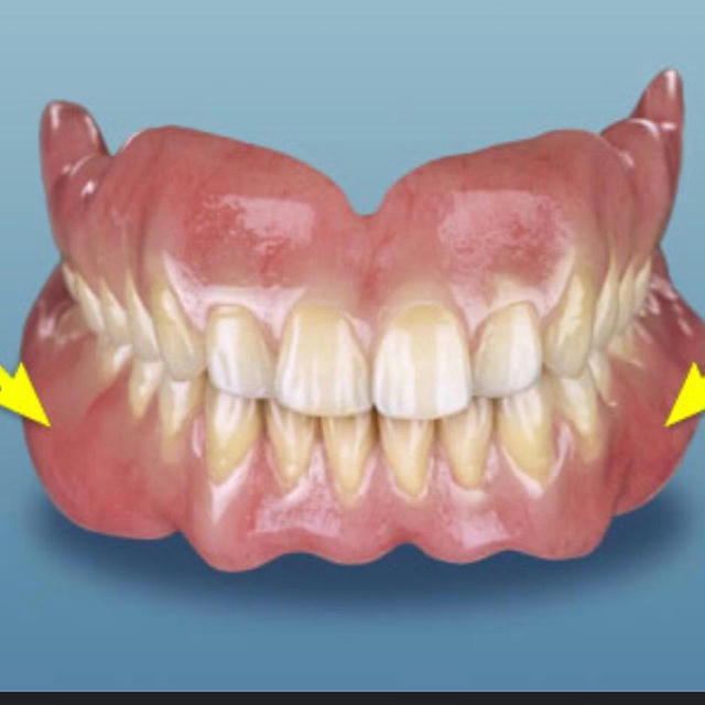 Fourth stage dental