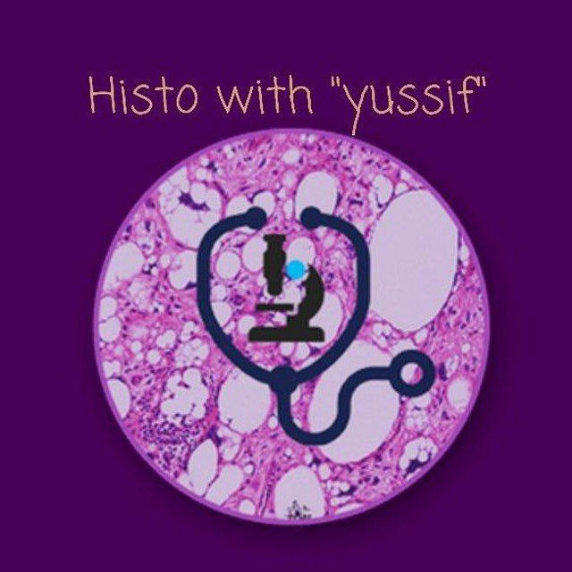 Histo with "yussif"