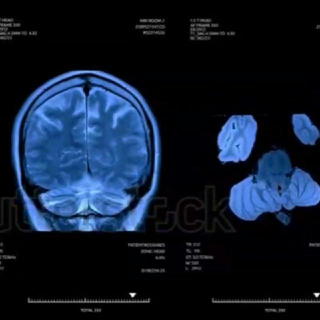 Psychology + neurology بلوك