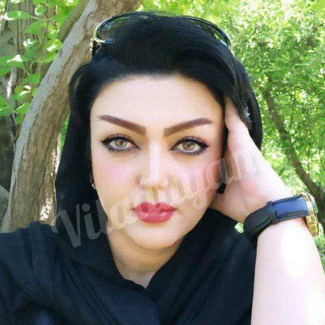 ویلا شمال دایان