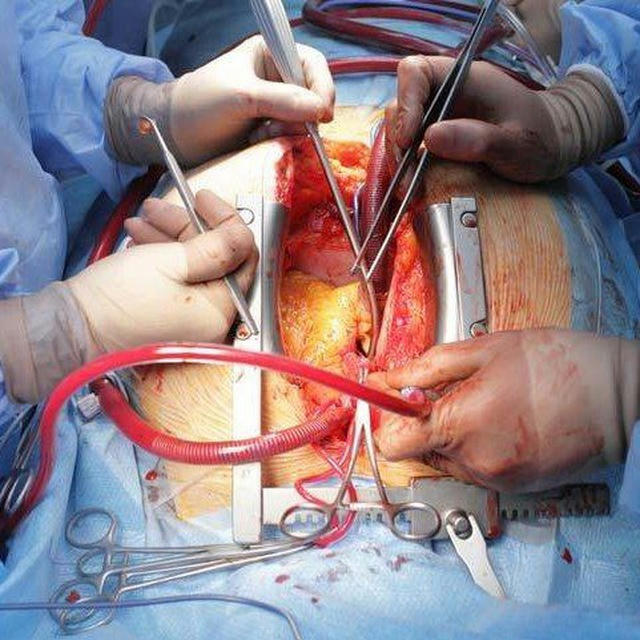 General Cardiothoracic surgery 🫁🫀